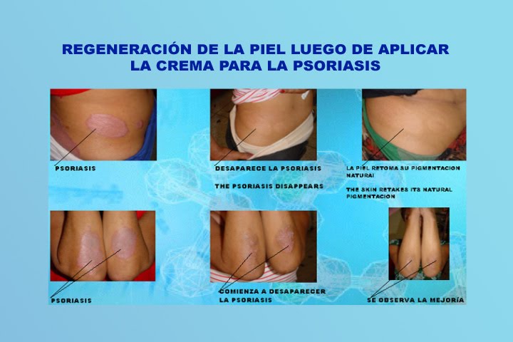 Las máscaras para la persona del limón de las pecas
